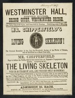 view [Undated, illustrated handbill (February 1867?) advertising an appearance at Westminster Hall by Robert Tipney, Mr. Chipperfield's Living Skeleton, 26 years old and weighing 49 pounds. ].