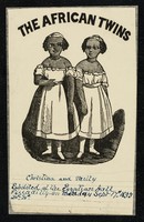 view [Small print (1860?) of Christina and Millie McCoy, 'The African Twins' (or Two-Headed Nightingale) conjoined twin girls, born in North Carolina in 1851. Their mother was a slave].