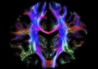 view Healthy human brain from a young adult, tractography.