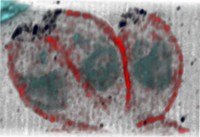 view Toxoplasma gondii tachyzoites, SIM.