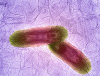 view Nanographene oxide interacting with bacteria, TEM.