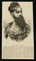 view [Undated, illustrated (cutting? leaflet?) about bearded Annie Jones-Elliot, "The Esau Lady"].