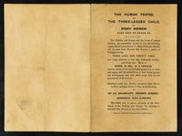 view [Leaflet advertising appearances by the 6 month old John Baptist Dos Santos, born with 3 legs, 2 penises and 4 testicles in Portugal 1843 on display at no.56, Quadrant, Regent Street, London].