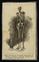 view [Newspaper clipping showing the skeletons of Mademoiselle Crachani, a Sicilian dwarf and Patrick O'Brien, the Irish Giant on display at the Royal College of Surgeons].