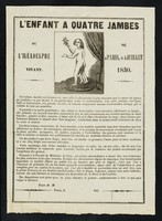 view L'enfant à quatre jambes : ou l'iléadelphie vivant : né à Paris, le 4 juillet 1830.