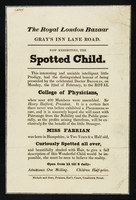 view The Royal London Bazaar, Gray's Inn Road : now exhibiting, the Spotted Child ... Miss Fabrian was born in Hampshire is two years & a half old, curiously spotted all over ...