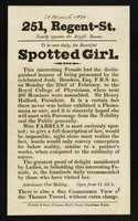 view 251, Regent-St. nearly opposite the Argyll Rooms : to be seen daily, the beautiful Spotted Girl ... Miss Fabian is most curiously spotted ...