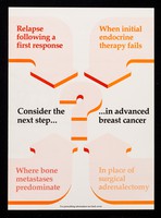 view Consider the next step......in advanced breast cancer : Orimeten...the next step in advanced breast cancer.