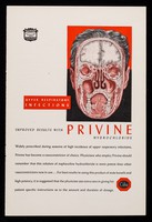 view Upper respiratory infections : improved results with Privine hydrochloride.