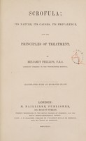 view Scrofula : its nature, its causes, its prevalence, and the principles of treatment / [Benjamin Phillips].