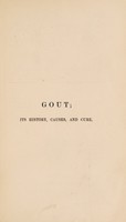 view On gout; its history, its causes, and its cure / [William Gairdner].