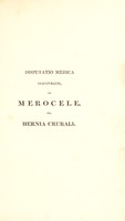view Dissertatio medica inauguralis de merocele, vel hernia crurali / [James Barry].