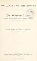 view On cancer of the tongue : the Bradshaw lecture delivered before the Royal College of Surgeons of England, on Thursday, November 14th, 1918 / by D'Arcy Power.