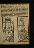 view The noble experyence of the vertuous handy warke of surgeri / practysyd & compyled by the moost experte mayster Jherome of Bruynswyke borne ine Straesborowe in Almayne ye whiche hath it fyrst proved and trewly founde by his awne dayly exerycsynge ... Here also shall ye fynde for to cure & hele all wounded membres, and other swellynges ... Item here shall ye fynde also for to make salves, plasters, powders, oyles, and drynkes for woundes.