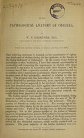 view On the pathological anatomy of cholera / [Sir W.T. Gairdner].