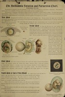 view The Antikamnia foetation and parturition chart / by Louis Crusius.