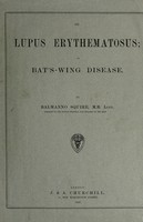 view On lupus erythematosus; or bat's-wing disease / by Balmanno Squire.