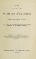 view On the application of vulcanized india rubber for making artificial palates, and for supplying the deficiencies in jaws caused by surgical operations for the removal of disease / by George Parkinson.