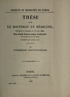 view De l'exostose sous-unguéale ... / par José-Fernandez Vallin.