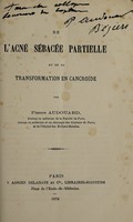 view De l'acné sebacée partielle et de sa transformation en cancroide / par Pierre Audouard.