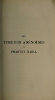 view Les tumeurs adénoides du pharynx nasal : leur influence sur l'audition la respiration et la phonation leur traitement / B. Lœwenberg.