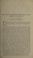 view On a peculiar ringed affection the prepuce and glans / by R.W. Taylor.