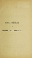 view Fistule ombilicale et cancer de l'estomac / par H. Feulard.