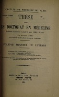 view Polypes muqeux de l'utérus ... / par Augustin Comet.