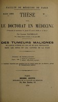 view Des tumeurs malignes de l'angle interne de l'oeil et de leur propagation dans les sinus et les cavités de la face ... / par Gabriel Faussillon.