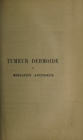 view Tumeur dermoide du médiastin antérieur / par J.-J.-A. Dardignac.