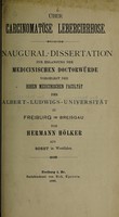 view Über carcinomatöse Lebercirrhose ... / von Hermann Hölker.