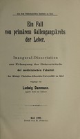 view Ein Fall von primärem Gallengangskrebs der Leber ... / vorgelegt von Ludwig Dammann.