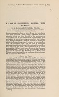 view A case of eosinophile ascites : with remarks / by H.D. Rolleston.