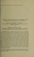 view A case of atypical myeloid leukæmia with nodular infiltration of the skin / by H.D. Rolleston, M.D., F.R.C.P., ... and Wilfrid Fox, M.D., M.R.C.P.