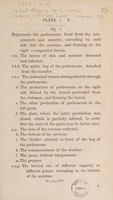 view Illustrations to Mr. S. Cooper's Surgical dictionary / [W.P. Cocks].