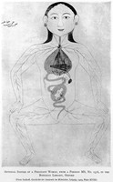 view M0000415: arterial system of a pregnant woman, from Choulant: <i>History and bibliography of anatomic illustration</i>