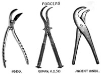 view M0001233: Forceps. 1929, compared with Roman A.D. 50 and ancient Hindu
