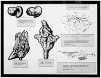 view M0001181: Prehistoric pathology: framed display board