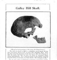 view M0001119: Galley Hill skull found in 1888 at Northfleet, Kent