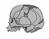 view M0001121: Magdalenian skull from the Rock Shelter of Raymonden