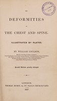 view On deformities of the chest and spine / Illustrated by plates. By William Coulson.