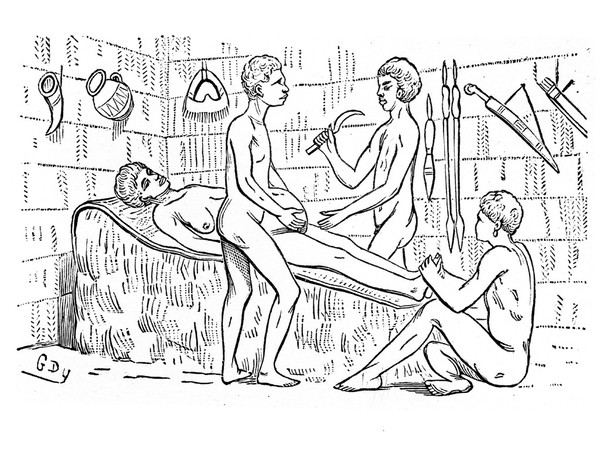 M0001893: Book illustration depicting childbirth with surgical intervention