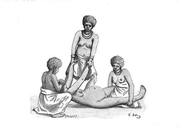 M0001882: Book illustration depicting one of the stages of childbirth