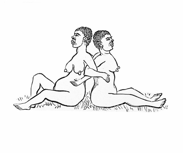 M0001861: Book illustration depicting one of the stages of childbirth