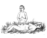 view M0001869: Book illustration depicting one of the stages of childbirth