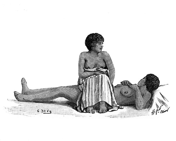 M0001878: Book illustration depicting one of the stages of childbirth
