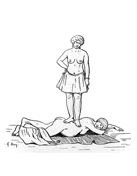 M0001881: Book illustration depicting one of the stages of childbirth