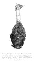 view M0003696: Lancet with end of handle wound with Llama wool