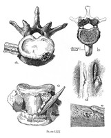 view M0004680: Five illustrations of stone age injuries from Neolithic period