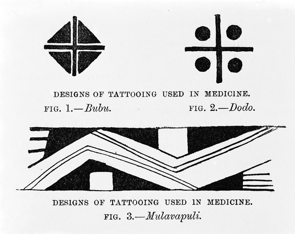 M0005576: Tattoo designs used in medicine